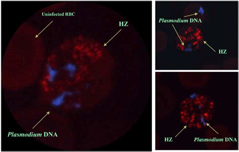 Hemozoon!  A Parasitic Prowler Hiding in Plain Sight Among Its Blood-Borne Brethren