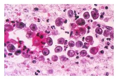  Naegleria fowleri: Czy ten mikroskopijny drapieżnik może stać się Twoim nocnym koszmarem?