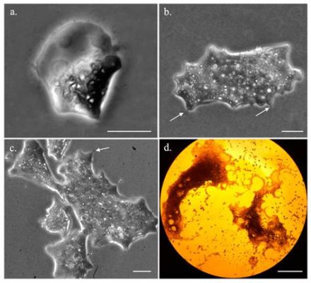  Quadrulella! An Enigmatic Amoeba That Defies Categorization With Its Bizarre Morphology